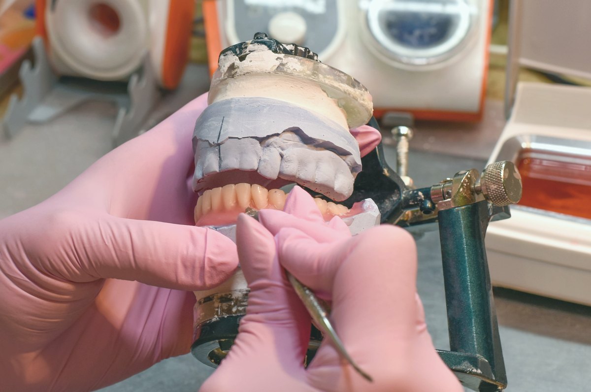 Dentures being crafted in a dental laboratory